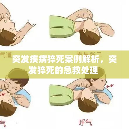 突发疾病猝死案例解析，突发猝死的急救处理 